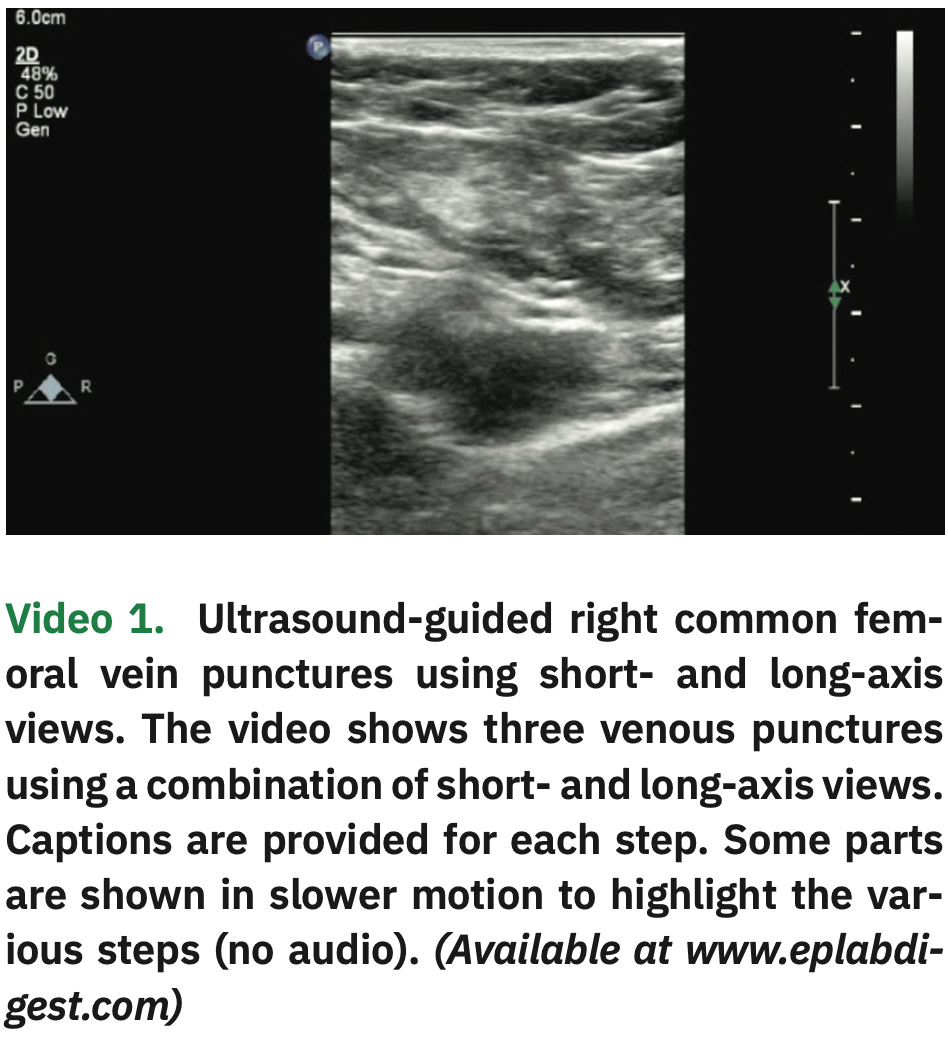 Integrating LongAxis and ShortAxis Views with a Twist for Ultrasound